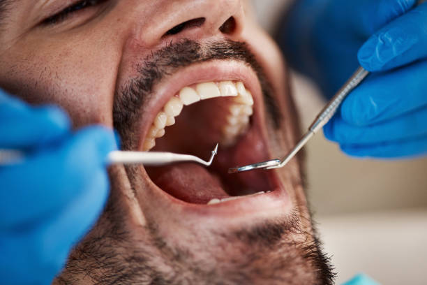 Best Mobile Emergency Dentist in San Leandro, CA